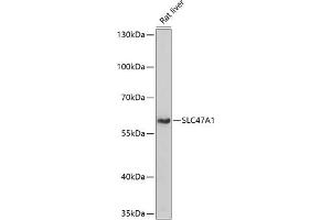 Western blot analysis of extracts of rat liver, using SLC47 antibody (4559) at 1:1000 dilution. (SLC47A1 Antikörper  (AA 460-550))