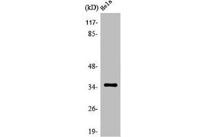 Western Blot analysis of Jurkat cells using Olfactory receptor 5F1 Polyclonal Antibody (OR5F1 Antikörper  (C-Term))
