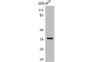 OR5F1 Antikörper  (C-Term)