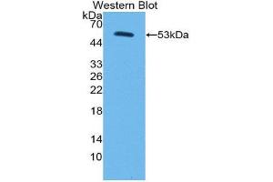Western Blotting (WB) image for anti-Corin, Serine Peptidase (CORIN) (AA 134-573) antibody (ABIN3203378) (Corin Antikörper  (AA 134-573))