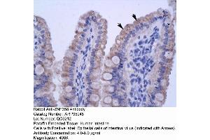 Human Intestine (ZNF358 Antikörper  (N-Term))