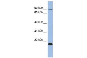 WB Suggested Anti-TCEB3B  Antibody Titration: 0. (TCEB3B Antikörper  (Middle Region))