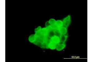 Immunofluorescence of purified MaxPab antibody to CX3CR1 on 293T cell. (CX3CR1 Antikörper  (AA 1-355))