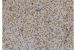 ABIN6279503 at 1/100 staining Mouse kidney tissue by IHC-P. (SIX3 Antikörper  (C-Term))