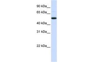 Image no. 1 for anti-DCP2 Decapping Enzyme Homolog (DCP2) (AA 324-373) antibody (ABIN6743046) (DCP2 Antikörper  (AA 324-373))
