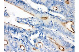 Immunohistochemistry (IHC) image for anti-Villin 1 (VIL1) (AA 770-799), (C-Term) antibody (ABIN3042343)
