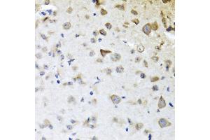 Immunohistochemistry of paraffin-embedded mouse brain using CPA6 antibody (ABIN6291611) at dilution of 1:100 (40x lens).