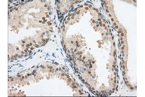 Immunohistochemical staining of paraffin-embedded Human Kidney tissue using anti-PDE4A mouse monoclonal antibody. (PDE4A Antikörper)