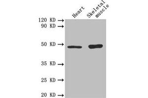 Western blot All lanes: TGFB2 antibody at 3 μg/mL Lane 1: Mouse heart tissue Lane 2: Mouse skeletal muscle tissue Secondary Goat polyclonal to rabbit IgG at 1/10000 dilution Predicted band size: 48, 51 kDa Observed band size: 48 kDa (TGFB2 Antikörper  (AA 304-413))