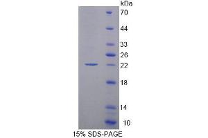 SDS-PAGE analysis of Human MOCS1 Protein.