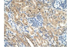 IHH antibody was used for immunohistochemistry at a concentration of 4-8 ug/ml to stain Epithelial cells of renal tubule (arrows) in Human Kidney. (Indian Hedgehog Antikörper)