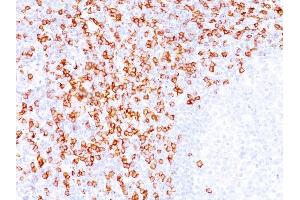 Formalin-fixed, paraffin-embedded human Tonsil stained with CD8A Mouse Monoclonal Antibody (C8/144B). (CD8 alpha Antikörper  (C-Term, Cytoplasmic Domain))