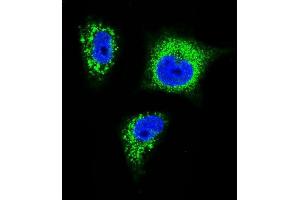 Confocal immunofluorescent analysis of TrkA Antibody f with MDA-M cell followed by Alexa Fluor 488-conjugated goat anti-rabbit lgG (green). (TRKA Antikörper)
