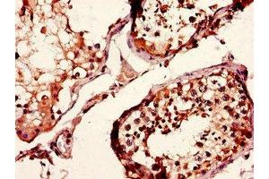 Immunohistochemistry of paraffin-embedded human testis tissue using ABIN7158234 at dilution of 1:100 (CD37 Antikörper  (AA 109-237))