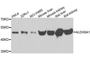 Western blot analysis of extracts of various cell lines, using ALDH9A1 antibody. (ALDH9A1 Antikörper)