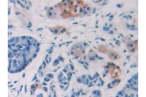 Immunohistochemistry (IHC) image for anti-Interleukin 15 (IL15) (AA 50-162) antibody (ABIN7430678)