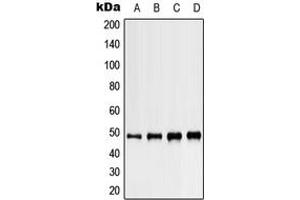 Western blot analysis of Kir3. (KCNJ5 Antikörper  (C-Term))