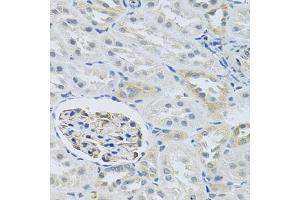 Immunohistochemistry of paraffin-embedded rat kidney using SLC29A1 antibody (ABIN6293826) at dilution of 1:100 (40x lens).