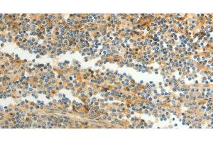 Immunohistochemistry of paraffin-embedded Human tonsil using CFHR1 Polyclonal Antibody at dilution of 1:40 (CFHR1 Antikörper)