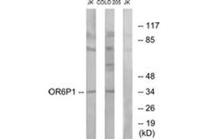 Western blot analysis of extracts from Jurkat/COLO cells, using OR6P1 Antibody. (OR6P1 Antikörper  (AA 160-209))