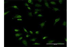 Immunofluorescence of monoclonal antibody to PRKRIP1 on HeLa cell. (PRKRIP1 Antikörper  (AA 1-184))
