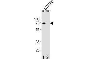 Western Blotting (WB) image for anti-Ets Variant 5 (ETV5) antibody (ABIN2995808) (ETV5 Antikörper)