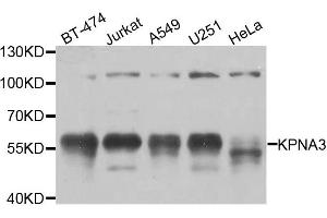 Western blot analysis of extracts of various cell lines, using KPNA3 antibody. (KPNA3 Antikörper)