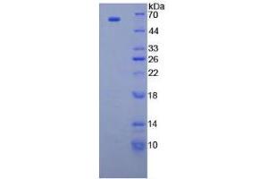 SDS-PAGE analysis of Human CUZD1 Protein. (CUZD1 Protein)