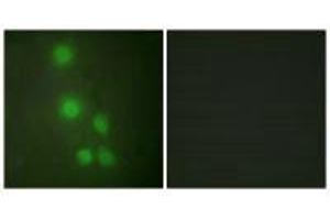 Immunofluorescence analysis of HUVEC cells, using ACL6A antibody. (BAF53A Antikörper)