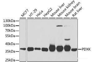 Western blot analysis of extracts of various cell lines using PDXK Polyclonal Antibody at dilution of 1:1000. (PDXK Antikörper)