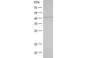 SALL4 Protein (AA 1-300) (His tag)