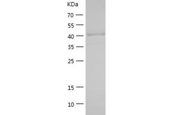 SALL4 Protein (AA 1-300) (His tag)