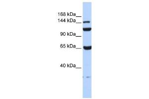 C17ORF57 antibody used at 1 ug/ml to detect target protein. (C17orf57 Antikörper  (N-Term))