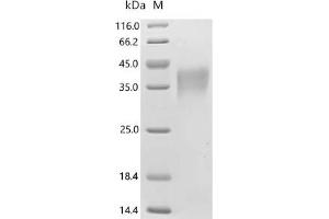 (Tris-Glycine gel) Discontinuous SDS-PAGE (reduced) with 5 % enrichment gel and 15 % separation gel.