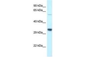 Image no. 1 for anti-Transmembrane Protein 117 (TMEM117) (AA 299-348) antibody (ABIN6747666) (TMEM117 Antikörper  (AA 299-348))
