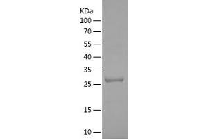 Western Blotting (WB) image for Thyroid Hormone Receptor Interactor 10 (TRIP10) (AA 472-601) protein (His-IF2DI Tag) (ABIN7125390)