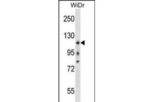 KIT Antibody (Center /) (ABIN1538491 and ABIN2838352) western blot analysis in WiDr cell line lysates (35 μg/lane). (KIT Antikörper  (AA 547-577))