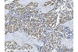 IHC analysis of ABL2 using anti-ABL2 antibody (ABIN4886412).