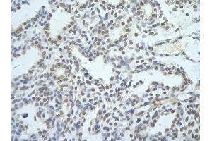 Rabbit Anti-NIP7 antibody   Paraffin Embedded Tissue: Human Lung cell Cellular Data: alveolar cell of renal tubule Antibody Concentration: 4. (NIP7 Antikörper  (Middle Region))