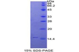 SDS-PAGE (SDS) image for Secreted LY6/PLAUR Domain Containing 1 (SLURP1) (AA 1-103) protein (His tag) (ABIN2126711)