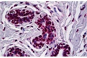 Human Breast: Formalin-Fixed, Paraffin-Embedded (FFPE) (RUNX1 Antikörper  (AA 210-311))