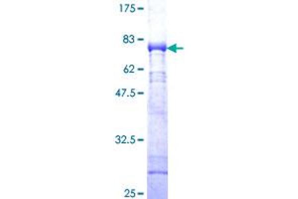 CAMK1 Protein (AA 1-370) (GST tag)