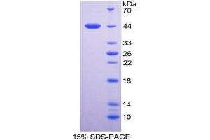 SDS-PAGE analysis of Human TNNT2 Protein. (Cardiac Troponin T2 Protein)