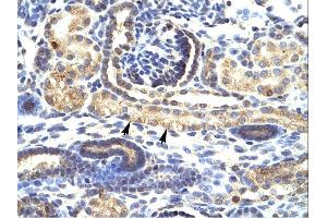 IHC Suggested Anti-SNAI1 Antibody Titration: 4-8ug/mlTissue: Human Kidney, epithelial cells of renal tube (indicated with arrows)Magnification:400X (SNAIL Antikörper  (N-Term))