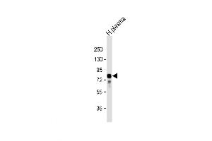 Western Blot at 1:32000 dilution + human plasma lysate Lysates/proteins at 20 ug per lane.