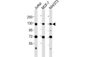 All lanes : Anti-MCM2 Antibody (C-term) at 1:2000 dilution Lane 1: Jurkat whole cell lysates Lane 2: MCF-7 whole cell lysates Lane 3: NIH/3T3 whole cell lysates Lysates/proteins at 20 μg per lane.