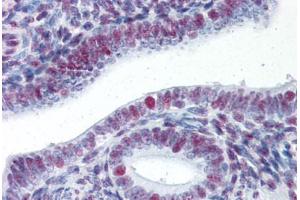 Human Uterus (formalin-fixed, paraffin-embedded) stained with HSF1 antibody ABIN337399 at 5 ug/ml followed by biotinylated goat anti-rabbit IgG secondary antibody ABIN481713, alkaline phosphatase-streptavidin and chromogen. (HSF1 Antikörper)