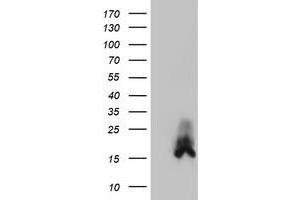 HEK293T cells were transfected with the pCMV6-ENTRY control (Left lane) or pCMV6-ENTRY DUSP23 (Right lane) cDNA for 48 hrs and lysed. (DUSP23 Antikörper)