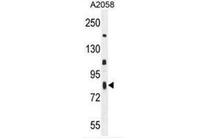 C6orf70 Antibody (Center) western blot analysis in A2058 cell line lysates (35µg/lane). (C6orf70 Antikörper  (Middle Region))