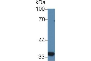 Detection of SLC30A8 in Human BXPC3 cell lysate using Polyclonal Antibody to Solute Carrier Family 30 Member 8 (SLC30A8) (SLC30A8 Antikörper  (AA 263-369))